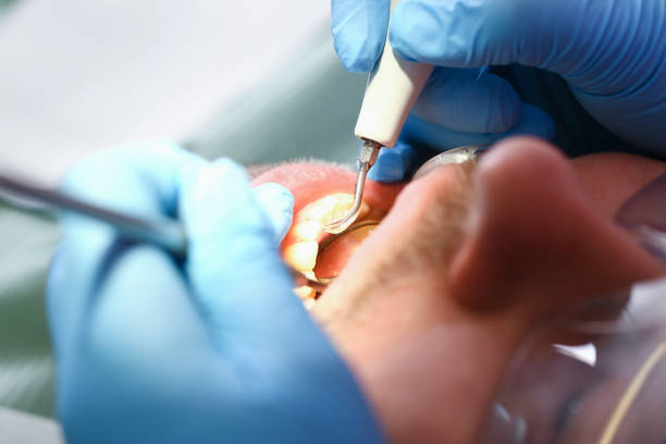 Best Emergency Treatment for Toothache in Laurel, FL